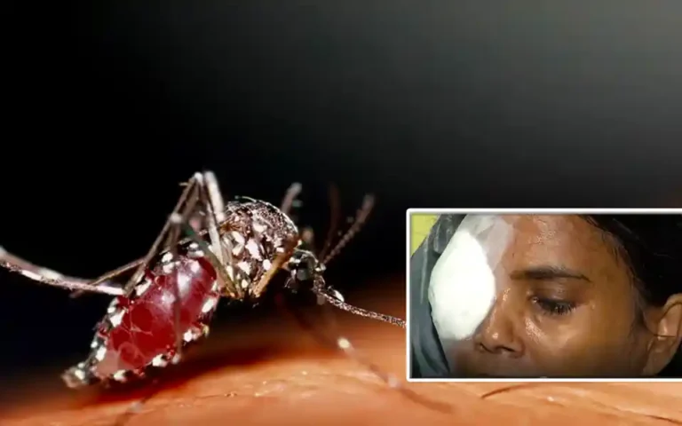 Sudden pain in the eyes, the eyes of dengue-affected women were destroyed!