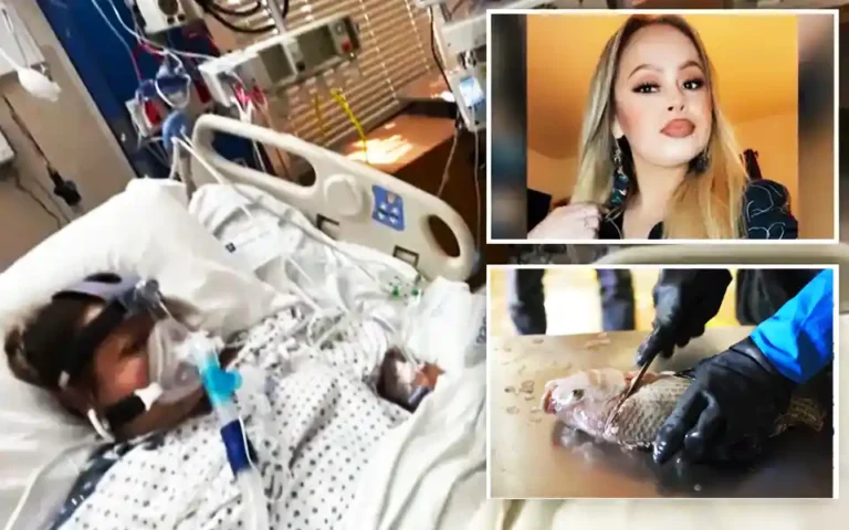 A woman lost four limbs after eating half-cooked tilapia fish