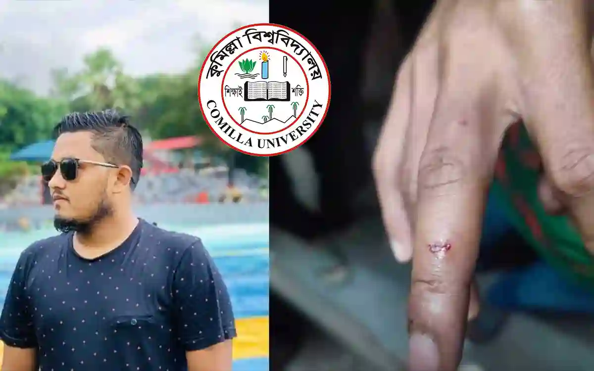 The senior bit the junior's hand