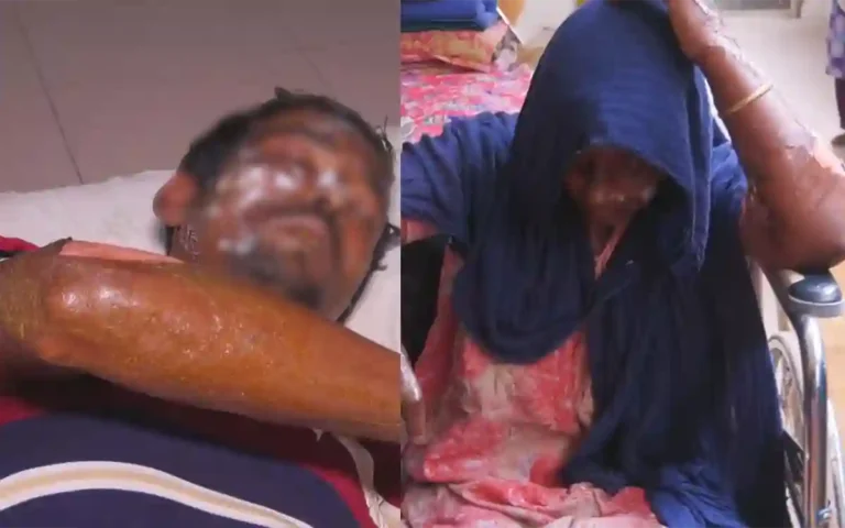 In Noakhali, an old man died after the power line snapped, burnt to death-3