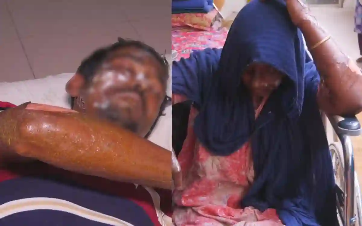 In Noakhali, an old man died after the power line snapped, burnt to death-3