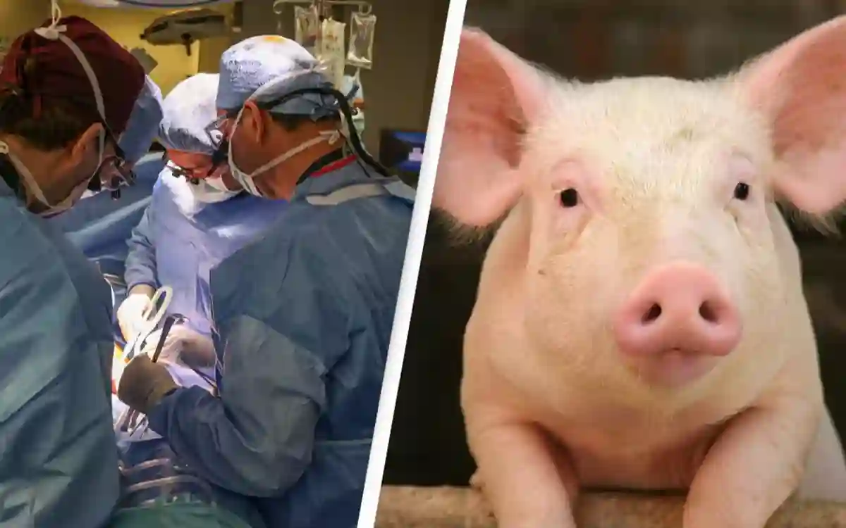 Pig kidney successfully transplanted into the human body