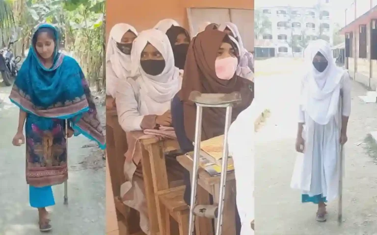 Yasmin goes to college by walking 3 kilometers on one leg