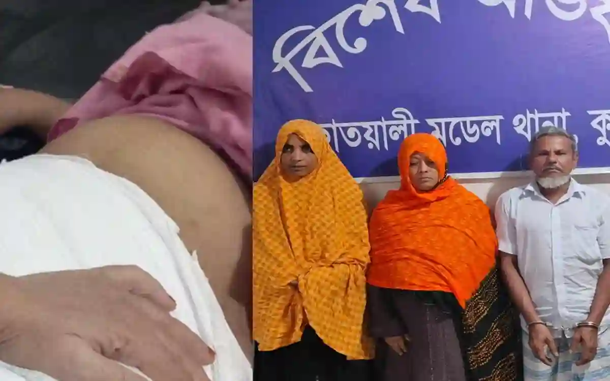 In Cumilla, wife was beaten with a hot knife for demanding dowry, 3 arrested