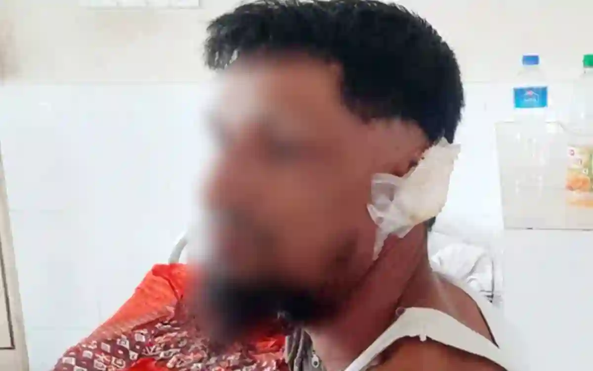 During the fight, the husband's ear was bitten by the wife, not attached