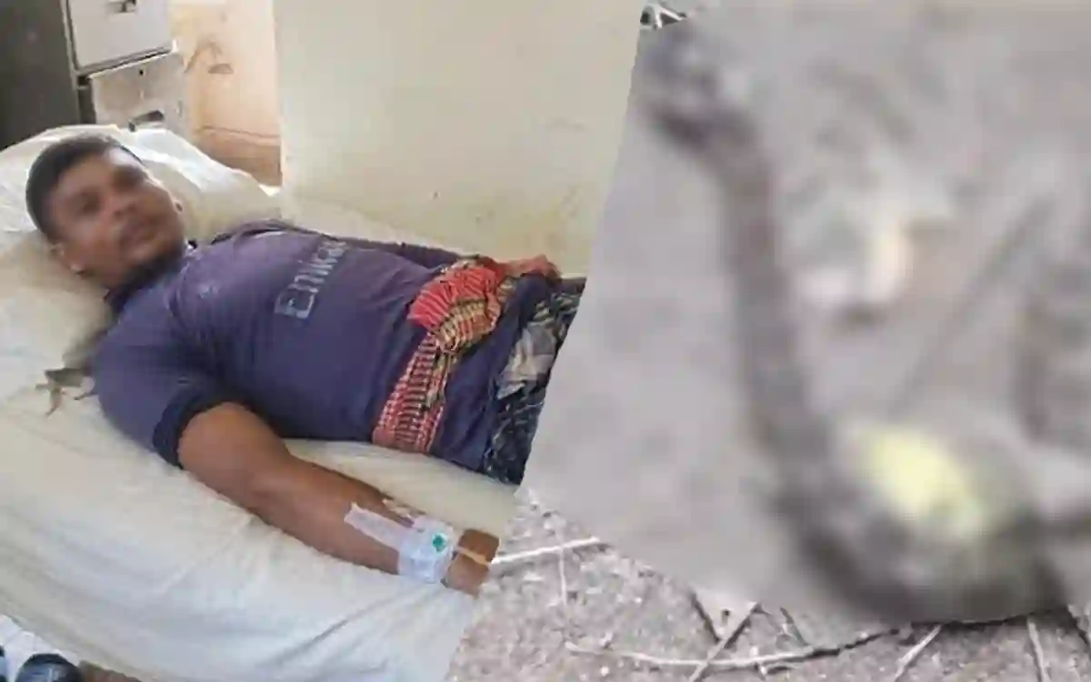 Farmers in hospital with snake bite in paddy field, Russell's viper