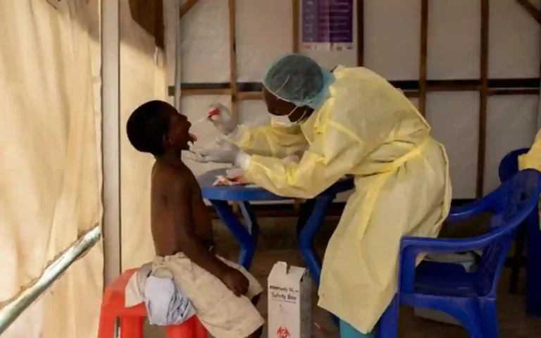 Rising Cumilla - monkeypox