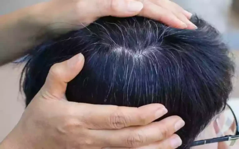 Rising Cumilla - White Hair