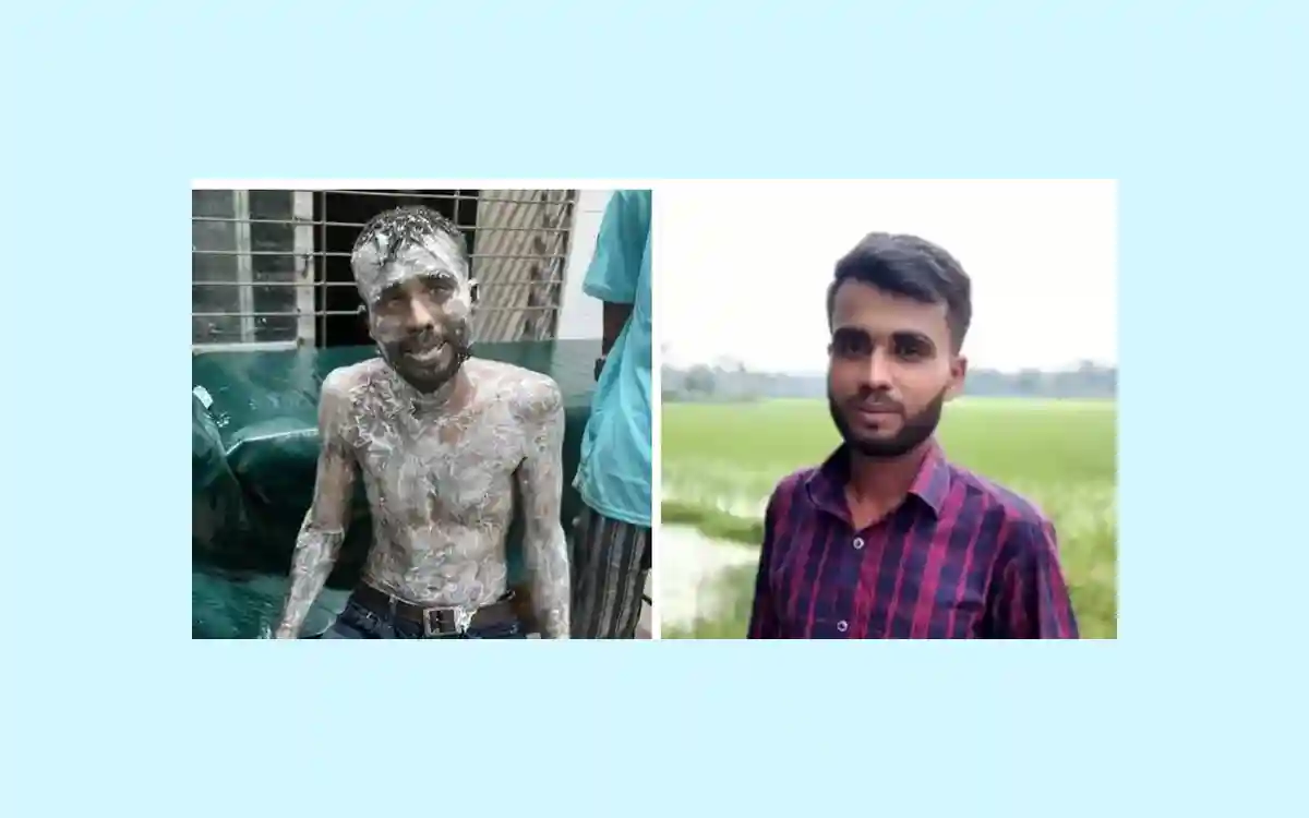 মৃত্যুর সঙ্গে পাঞ্জা লড়ে না ফেরার দেশে চলে গেলেন চান্দিনার অগ্নিদগ্ধ সবুজ