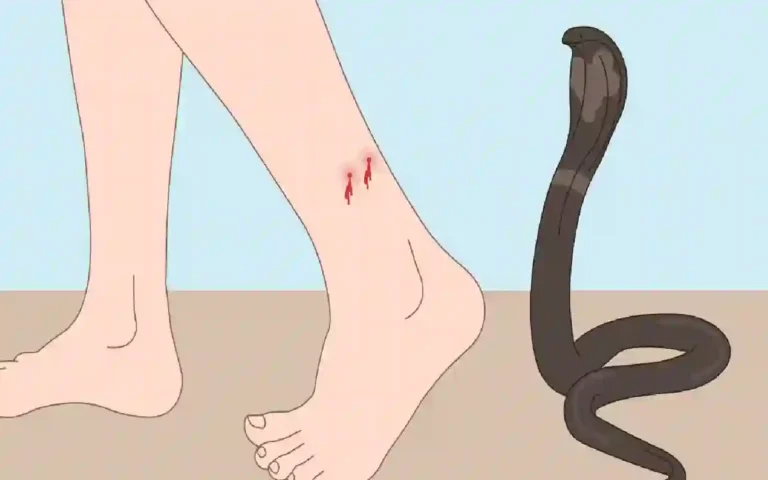 Rising Cumilla -Snake bite