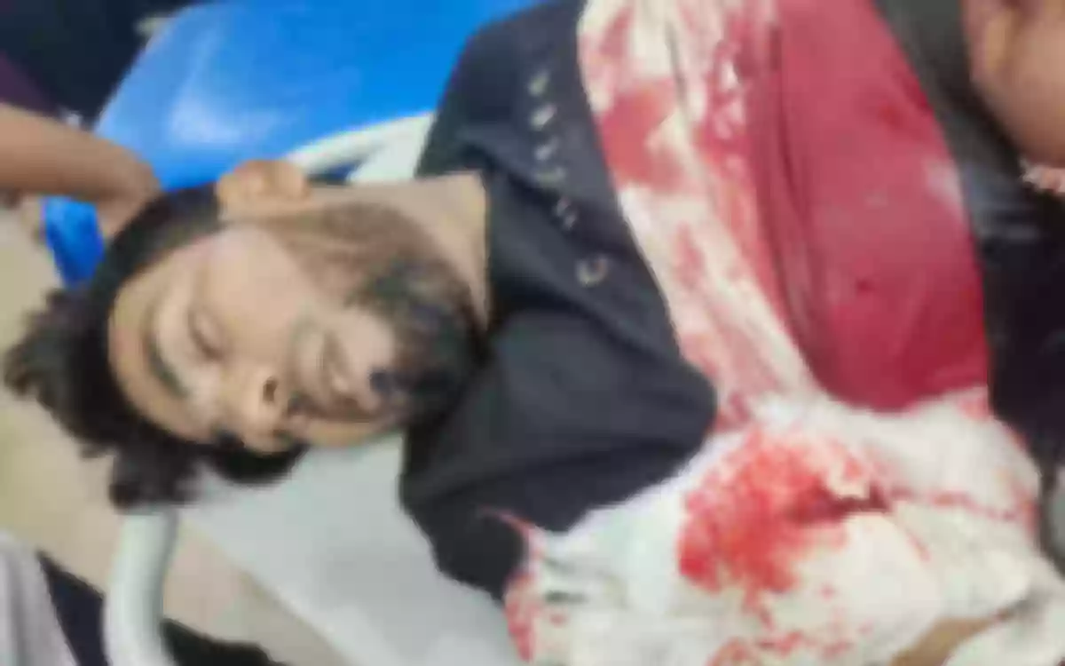 Rising Cumilla -Terrorists cut off expatriate's wrists in Noakhali after not receiving ransom