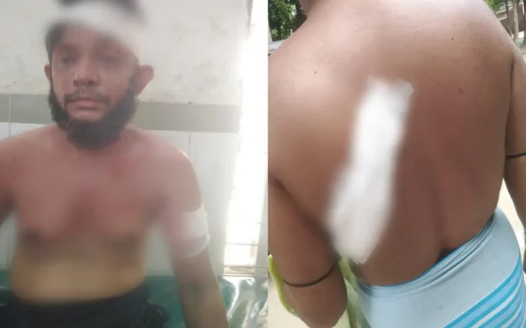 ব্রাহ্মণপাড়ায় ইভটিজারদের হামলায় রক্তাক্ত সংঘর্ষ, আহত ৪