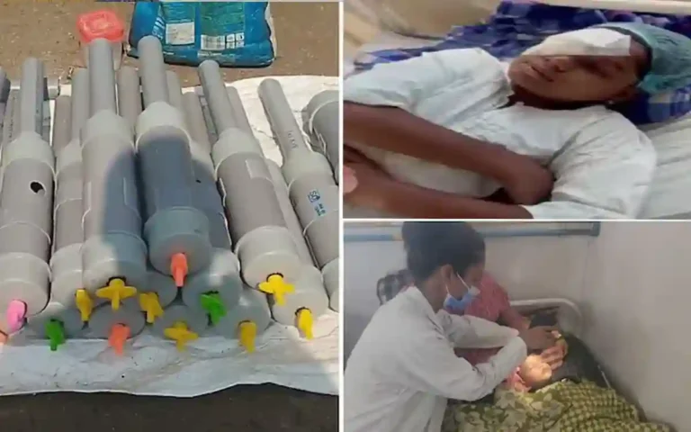 Rising Cumilla -14 go blind, hundreds injured while playing 'Carbide Song' on Diwali