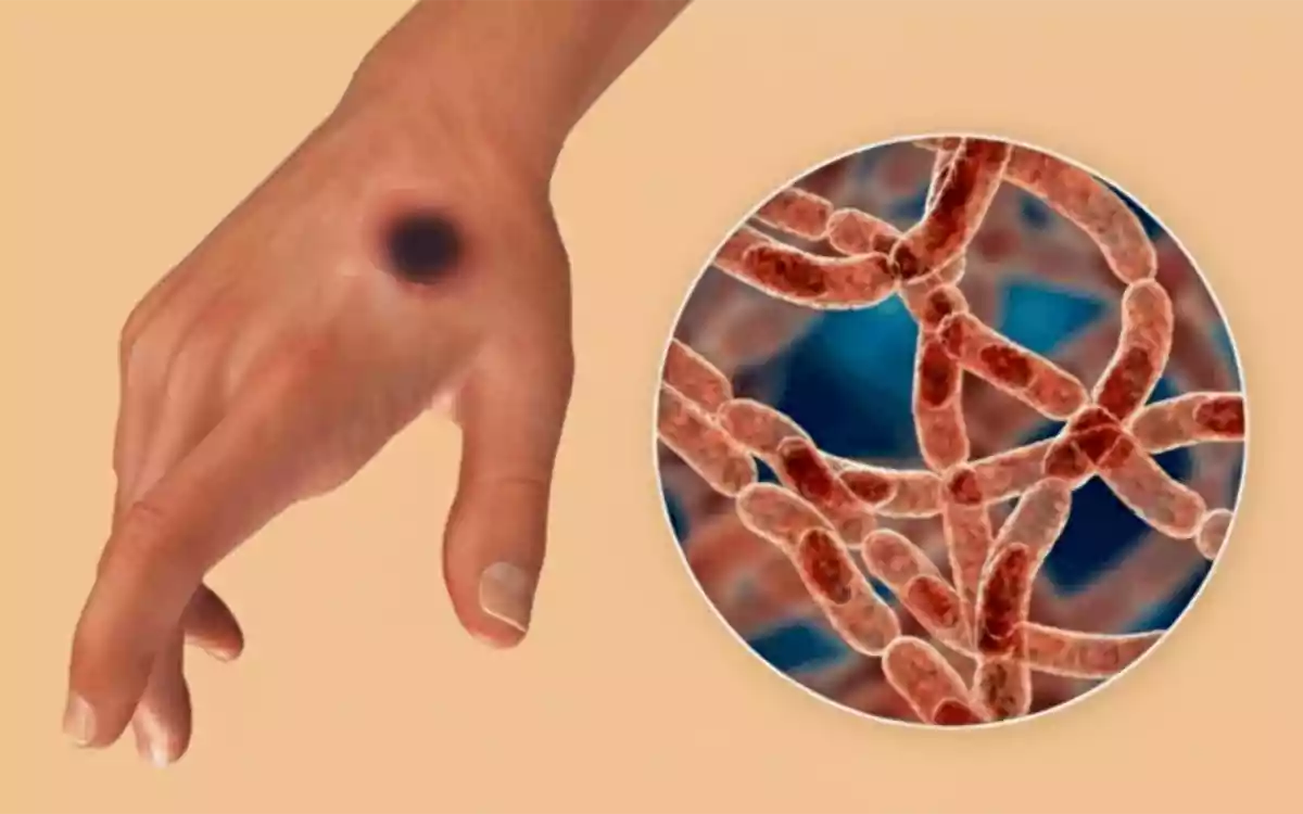 Rising Cumilla - Anthrax