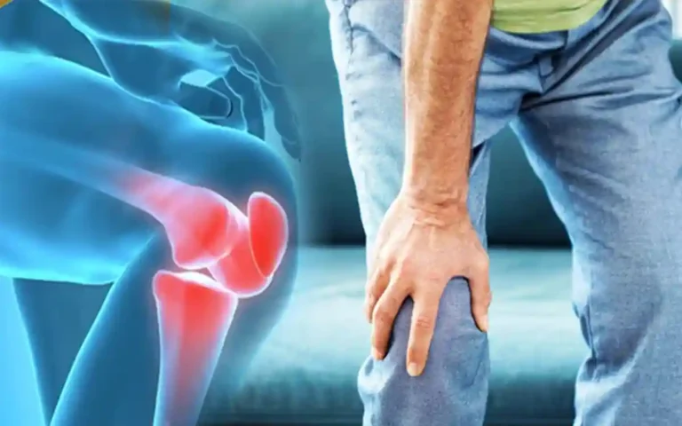 Rising Cumilla -Knee pain increases when it gets cold, know home remedies