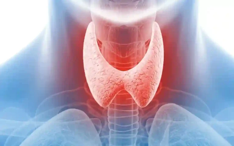 Rising Cumilla -Thyroid