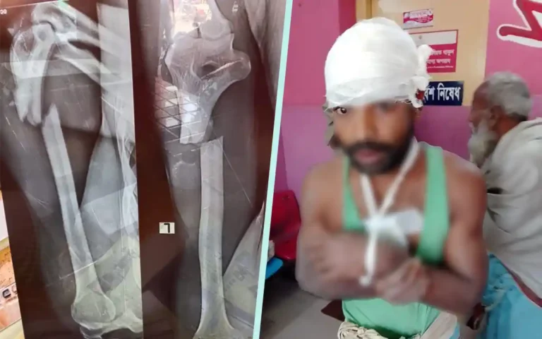 Rising Cumilla - Farmer's hand broken, slashed in Noakhali