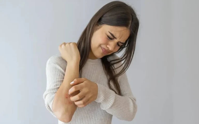 Rising Cumilla - Why does skin itch in winter- How to prevent it