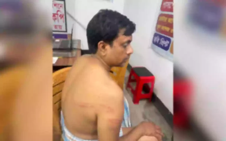 Rising Cumilla - BNP leader attacked for protesting land clearing, case filed at police station