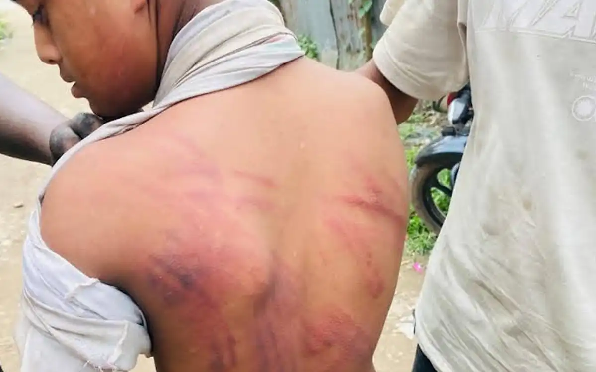কোম্পানীগঞ্জে দুটি আমের জন্য শিশুকে অমানবিক নির্যাতন