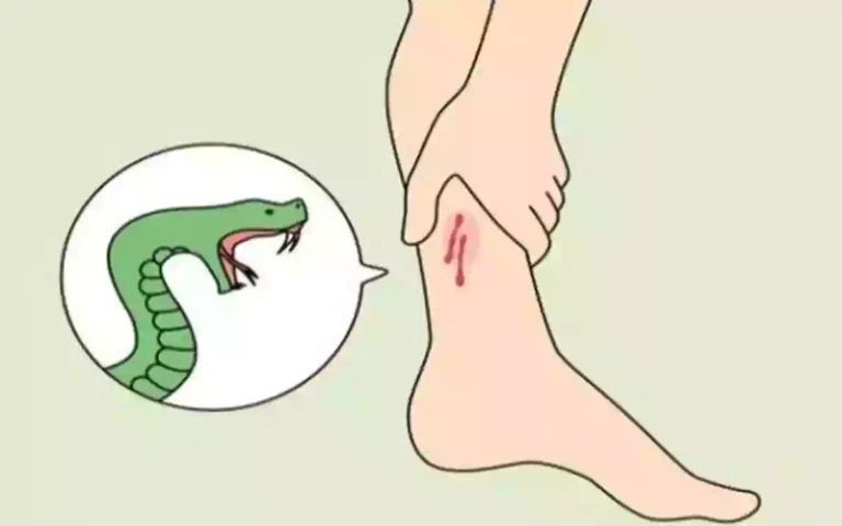 RisingCumilla - Snake bite