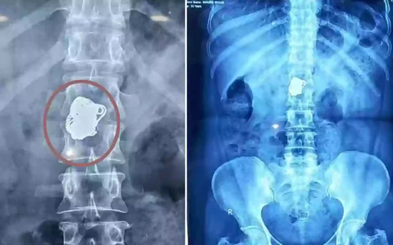 Rising Cumilla - Gold chain stolen in Noakhali by posing as a patient
