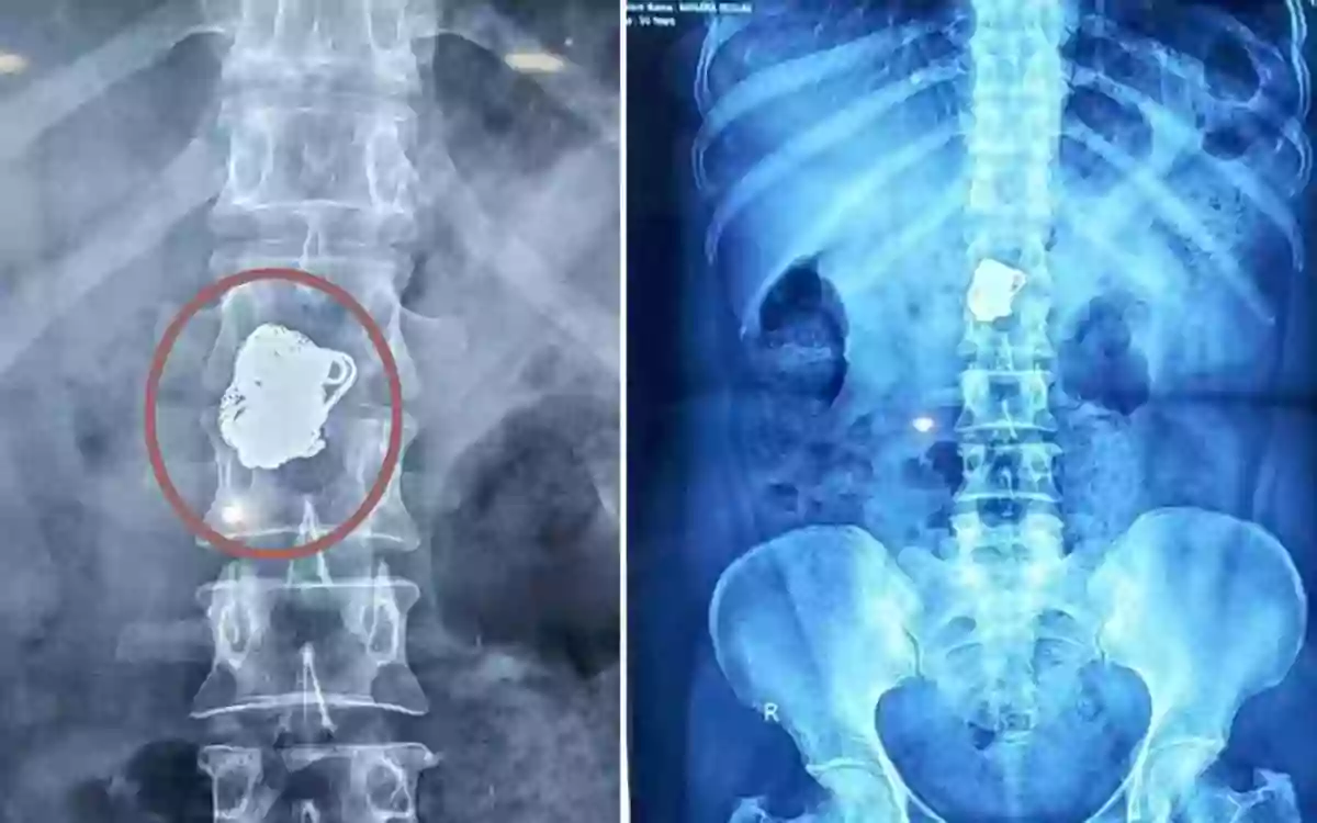 Rising Cumilla - Gold chain stolen in Noakhali by posing as a patient